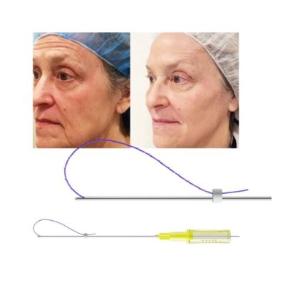 3D 4D 6D PDO Podnieś nić Nose Wstrzyknięcie Facelift Mono Tornado Śruba
