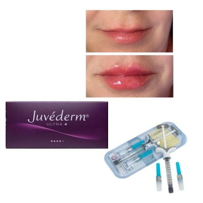 Długość działania 6-9 miesięcy Juvederm Dermal Filler Gel do zakupu online i w sklepie