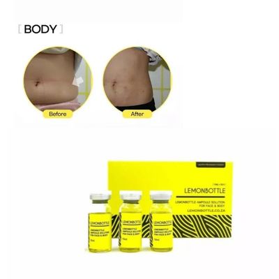 Sprzedaż Lemon Bottle Fat Dissolver 5X10ml Box Weight Loss Solution Online
