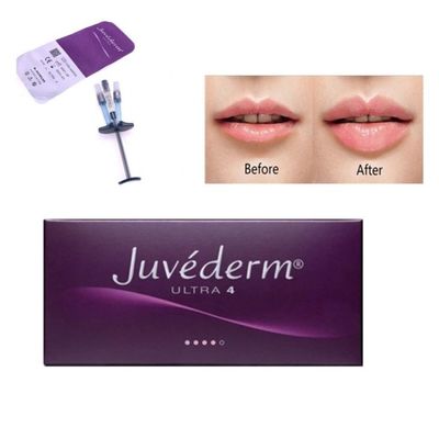 Allergan Juvederm Dermal Filler Injection Ultra4 z Lido