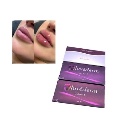 Wstrzyknięcie Juvederm Voluma Cross Linked Dermal Filler