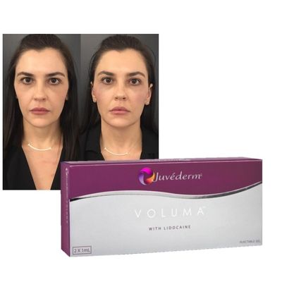 Żel wypełniający z kwasem hialuronowym Juvederm Lips Policzki Formuła wzmacniająca odmładzanie
