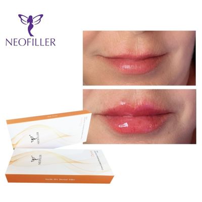 24 mg / ml 2 ml strzykawek Derm Hyaluronic Acid Dermal Filler