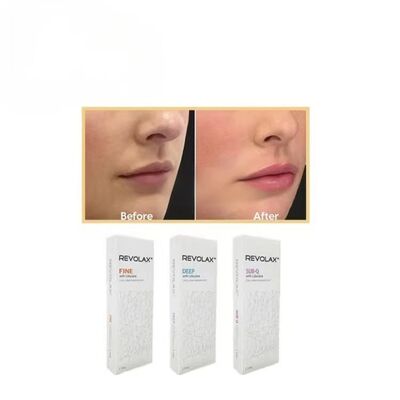 Cienkie, głębokie Sub-Q Revolax Dermal Filler o gładkiej i elastycznej konsystencji żelowej dla naturalnie wyglądającej regeneracji objętości twarzy