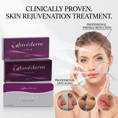 Juvederm Ultra 3 Wypełniacz Fałdów Nosowo-Wargowych Kwas Hialuronowy Wypełniacz Skórny Wygładzający Linię Uśmiechu 24mg/ml