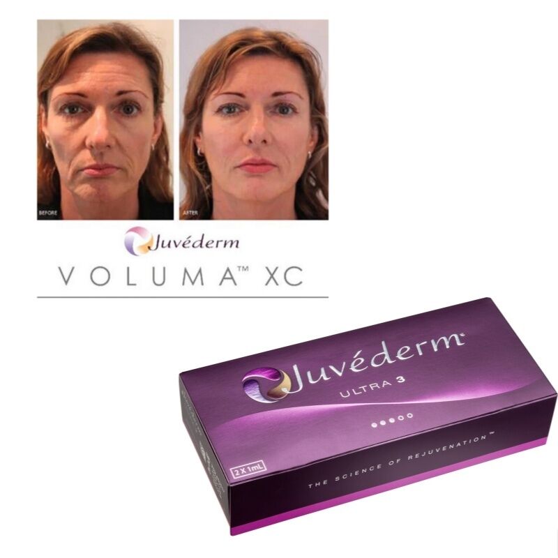 Korekta zmarszczek Juvederm Filler skórny kwas hialuronowy Żel do wstrzykiwań Długotrwałe leczenie wygładzania